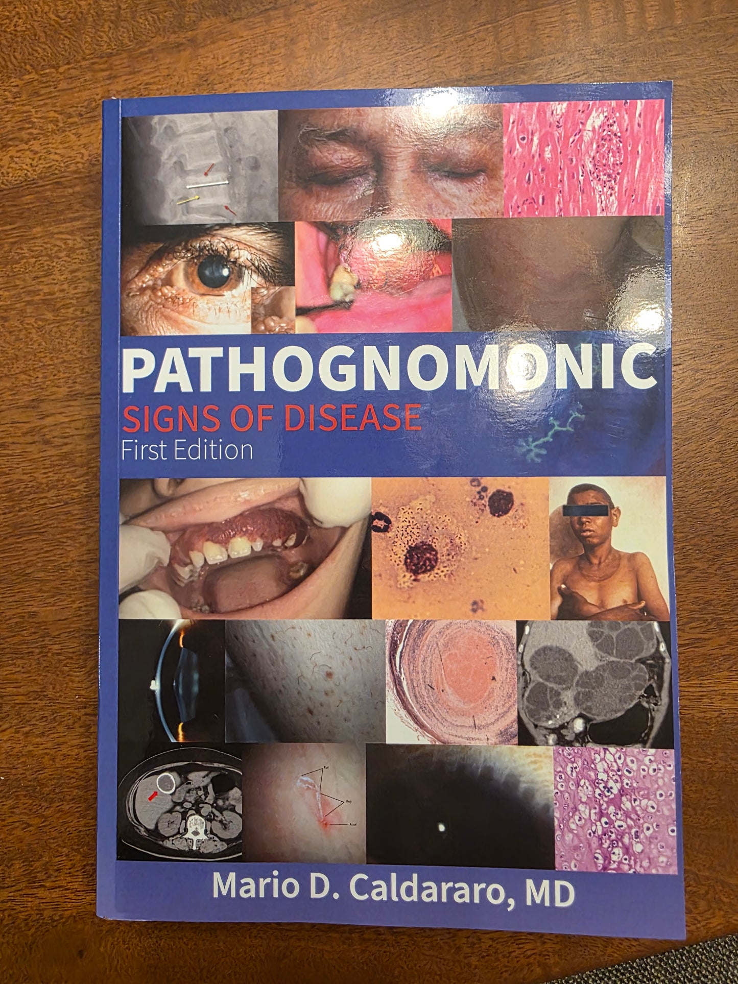 Pathognomonic Signs of Disease – 1st Edition (7x10 Paperback)