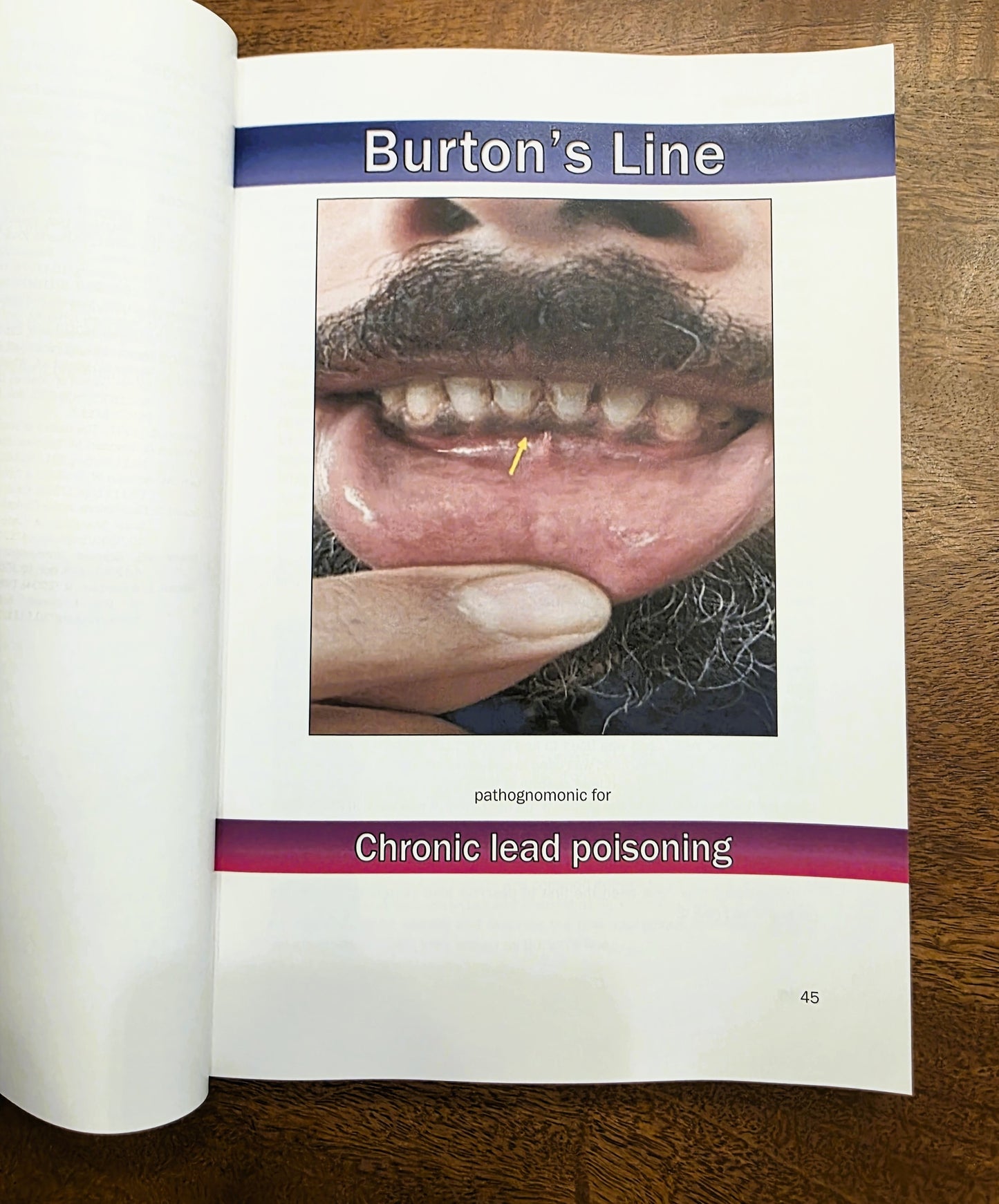 Pathognomonic Signs of Disease – 1st Edition (7x10 Paperback)