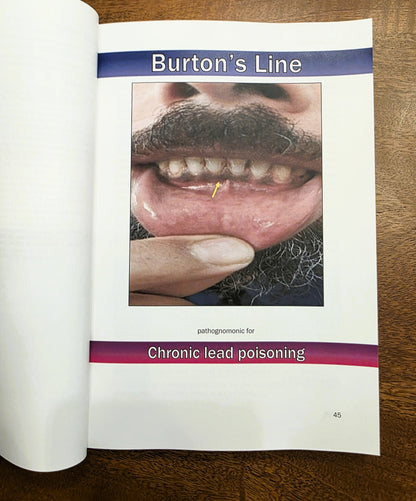 Pathognomonic Signs of Disease – 1st Edition (7x10 Paperback)