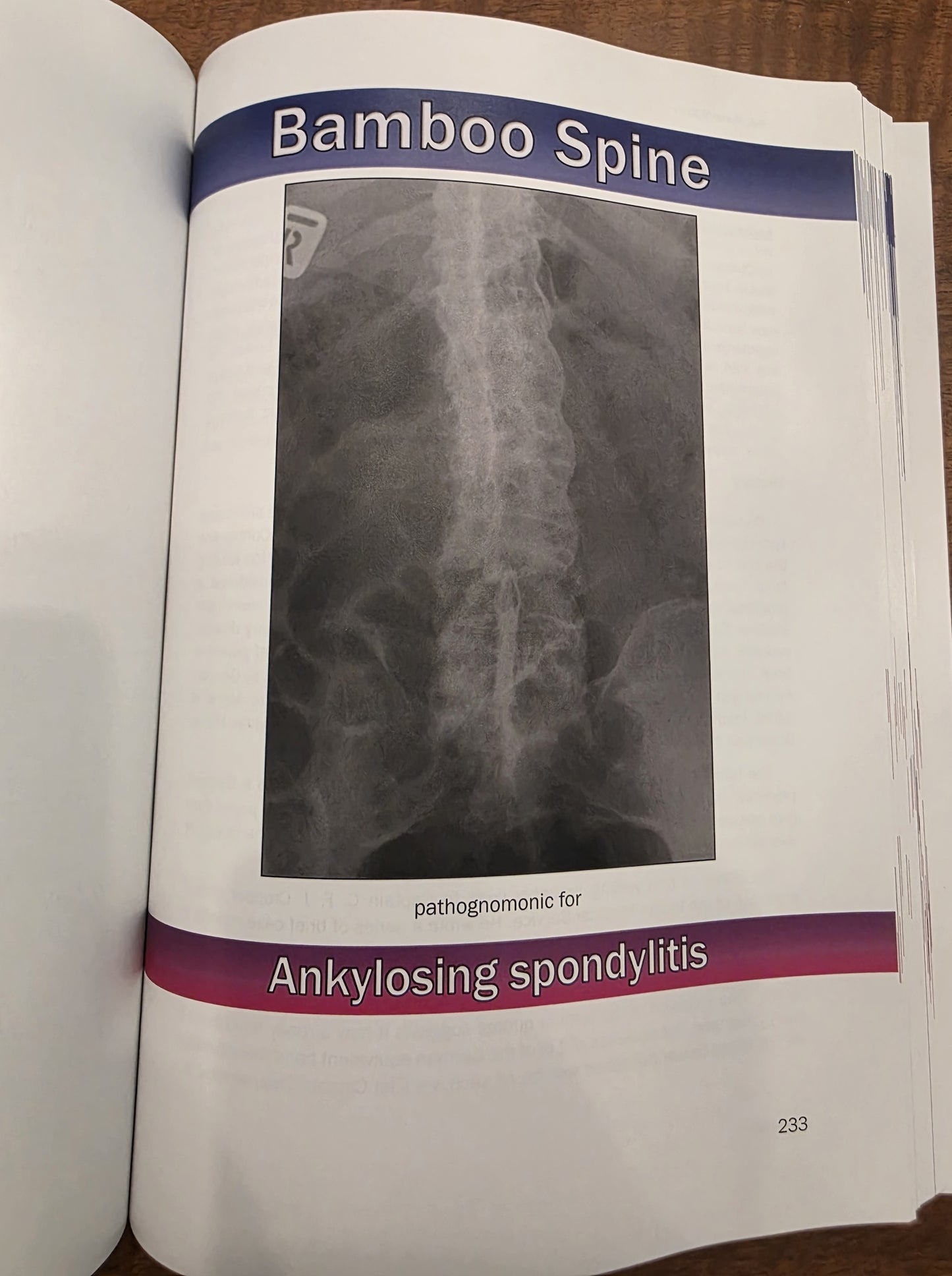 Pathognomonic Signs of Disease – Complete Bundle