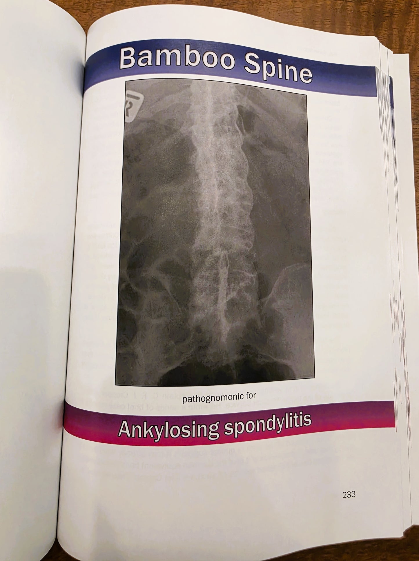 Pathognomonic Signs of Disease – 1st Edition (7x10 Paperback)