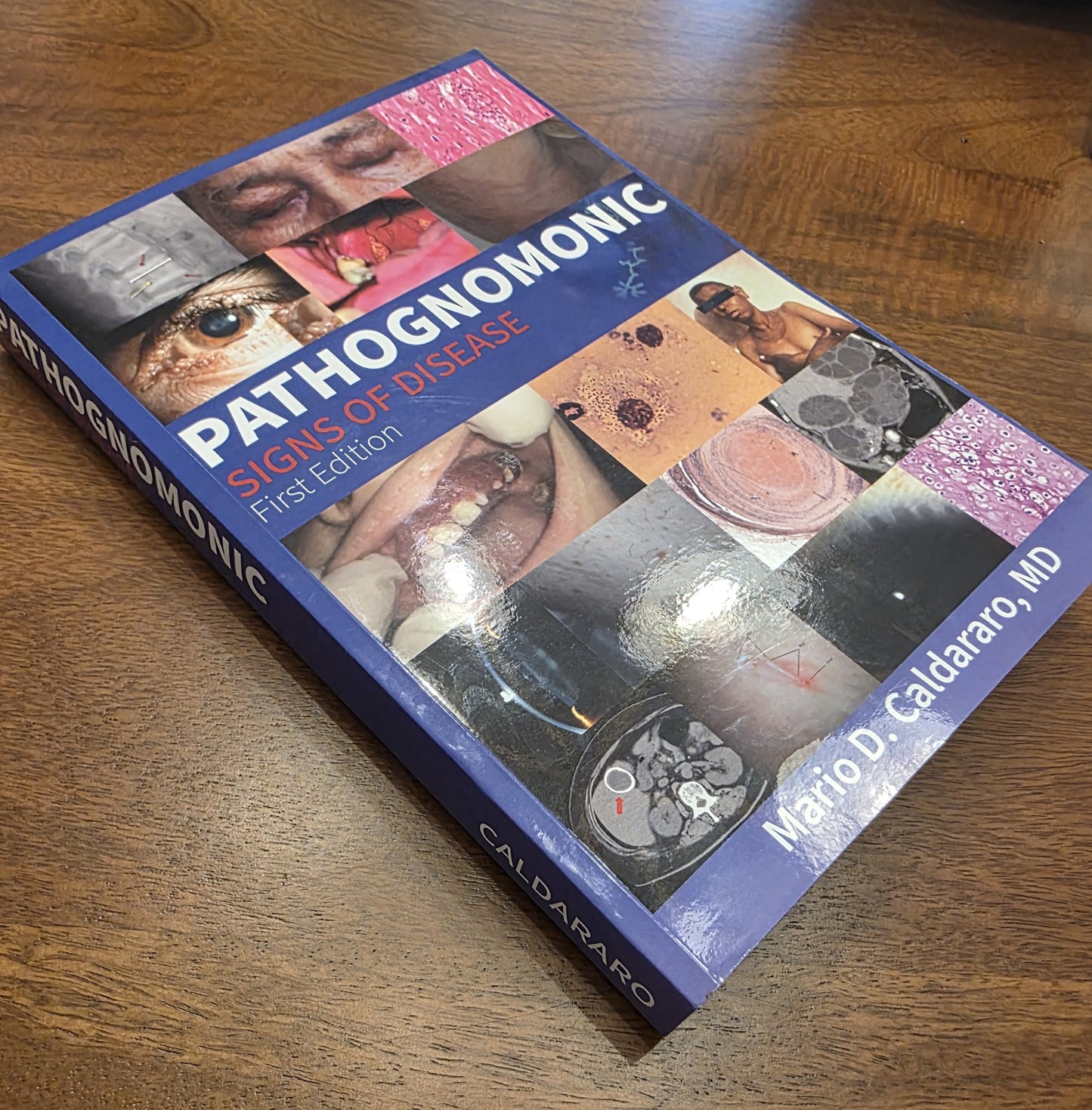 Pathognomonic Signs of Disease – 1st Edition (7x10 Paperback)