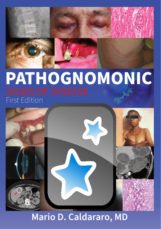 Pathognomonic Signs of Disease Official Anki Companion Deck
