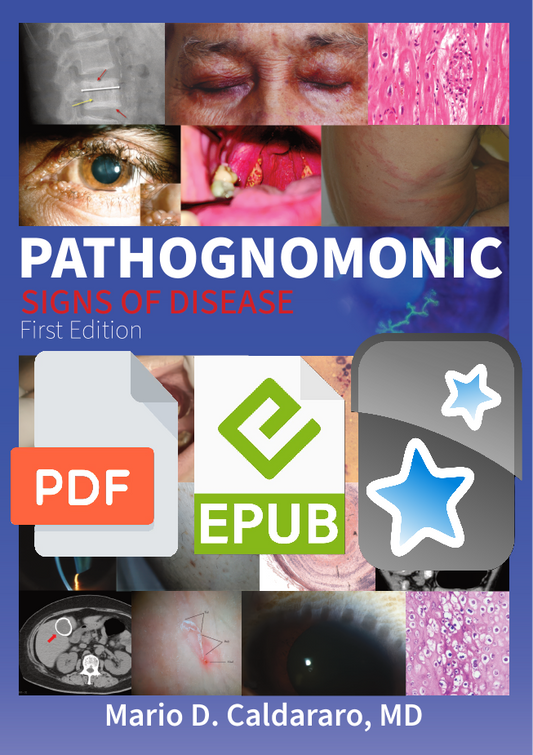 Pathognomonic Signs of Disease Digital Bundle (Ebook + Anki Deck)