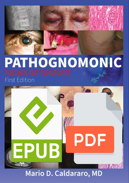 Pathognomonic Signs of Disease 1st ed. (Ebook)