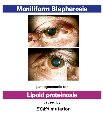 Pathognomonic Signs of Disease Digital Bundle (Ebook + Anki Deck)
